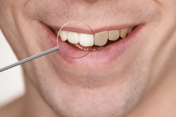 Estética Dentária: Transforme Seu Sorriso com os Melhores Tratamentos